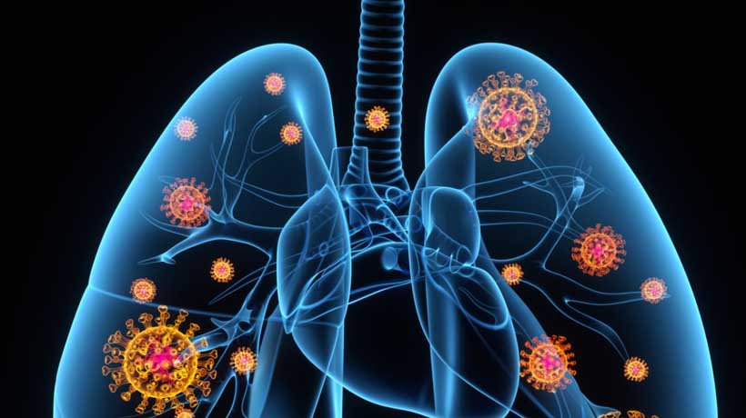 Ómicron infiltra más lento el tejido pulmonar que otras variantes