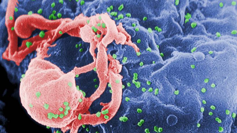 Por primera vez, se cura una mujer con VIH gracias a novedoso método