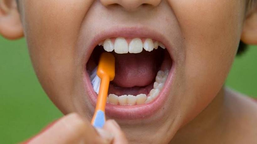 Sugiere IMSS Guerrero limpieza buco-dental para prevenir caries infantil