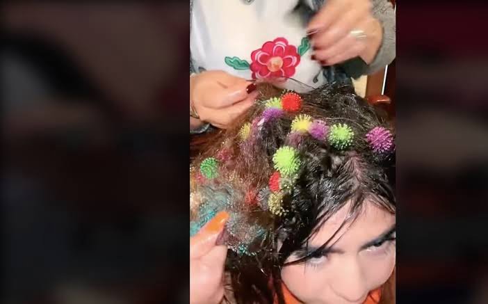 Tras dos horas, retiran más de 130 bunchems del pelo de una joven