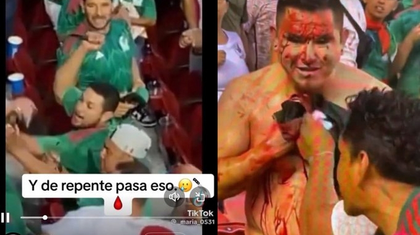 VIDEO: Apuñalan a aficionado en partido de la Selección Mexicana