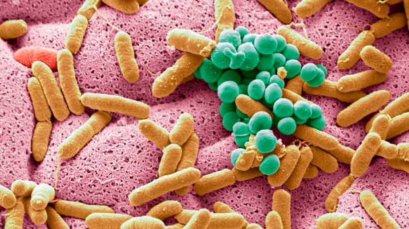 ¿Tienes muchos problemas de estómago? Ojo con  tu microbiota intestinal